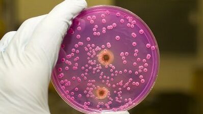 Patologický výtok u mužov, keď sú nadšení